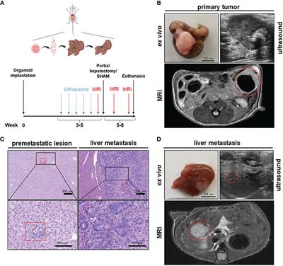 Partial hepatectomy accelerates colorectal metastasis by priming an inflammatory premetastatic niche in the liver